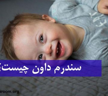 سندرم داون چیست؟