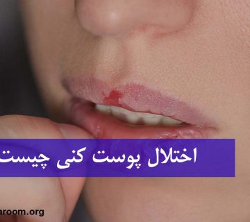 اختلال پوست کنی